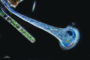 stentor protozoa